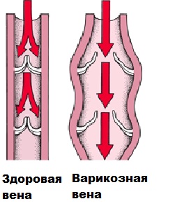 Большие вены на члене фото